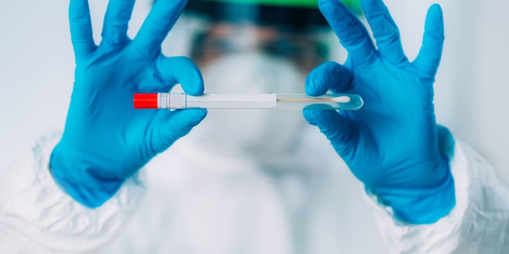 dna-test